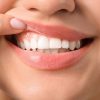 dietfind gums 1