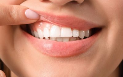 What Are The Best Foods And Supplements For Healthy Gums